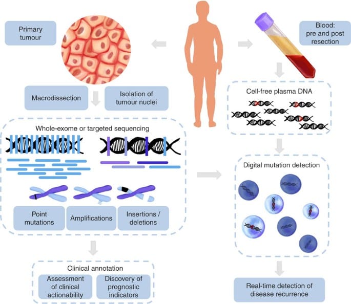 Cáncer de Páncreas y Genómica